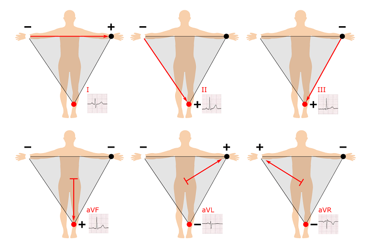 Einthoven's Triangle