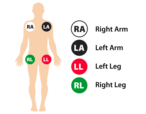شیوه لیدگذاری دستگاه ECG