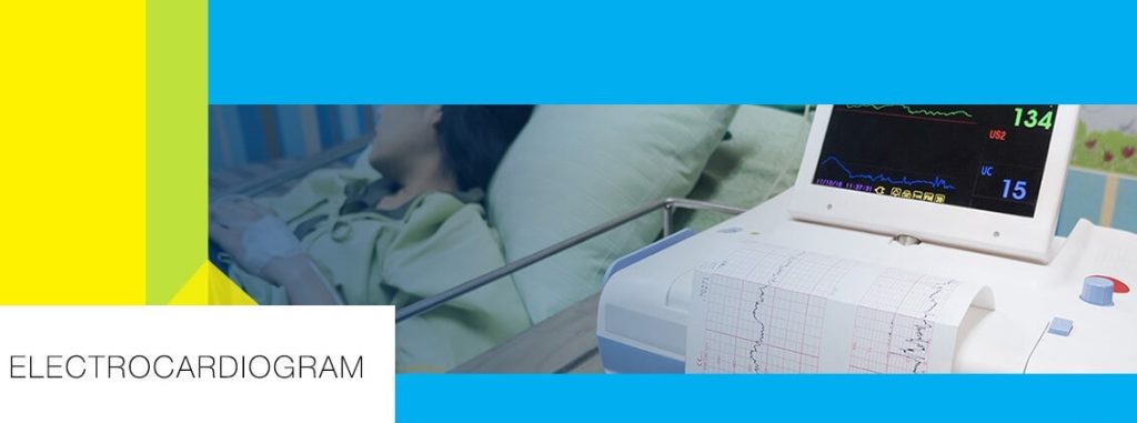 دستگاه الکتروکاردیوگرام (ECG)